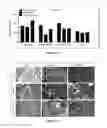 Fig. 09 - Management of ischemia using pooled mesenchymal stromal cell composition