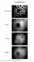 Fig. 18 - Lineage differentiation of encapsulated embryonic stem cells