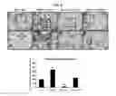 Fig. 18 - Use of CPNE7 for differentiating non-dental mesenchymal stem cells into odontoblasts, regenerating dental pulp and treating dentin hypersensitivity