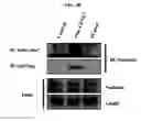 Fig. 22 - Use of CPNE7 for differentiating non-dental mesenchymal stem cells into odontoblasts, regenerating dental pulp and treating dentin hypersensitivity