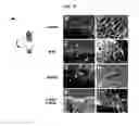 Fig. 30 - Use of CPNE7 for differentiating non-dental mesenchymal stem cells into odontoblasts, regenerating dental pulp and treating dentin hypersensitivity