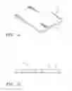 Fig. 03 - Cardiovascular Prostheses