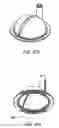 Fig. 113 - Hemodialysis systems and methods