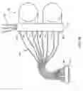 Fig. 24 - Hemodialysis systems and methods