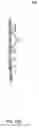 Fig. 84 - Hemodialysis systems and methods