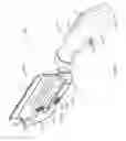 Fig. 04 - Occlusion sensing for an infusion pump