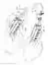 Fig. 08 - Occlusion sensing for an infusion pump