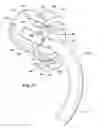 Fig. 07 - Ventilator to tracheotomy tube coupling