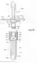 Fig. 10 - Ventilator to tracheotomy tube coupling