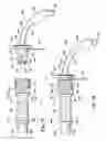 Fig. 12 - Ventilator to tracheotomy tube coupling