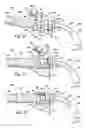 Fig. 16 - Ventilator to tracheotomy tube coupling