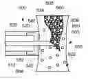 Fig. 01 - Methods, medical devices and kits for modifying the luminal profile of a body vessel