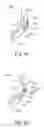 Fig. 03 - Methods, medical devices and kits for modifying the luminal profile of a body vessel