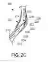 Fig. 04 - Methods, medical devices and kits for modifying the luminal profile of a body vessel