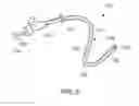 Fig. 07 - Methods, medical devices and kits for modifying the luminal profile of a body vessel