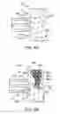 Fig. 09 - Methods, medical devices and kits for modifying the luminal profile of a body vessel