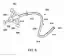 Fig. 11 - Methods, medical devices and kits for modifying the luminal profile of a body vessel