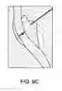 Fig. 13 - Methods, medical devices and kits for modifying the luminal profile of a body vessel