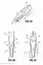 Fig. 06 - Symmetrical tip acute catheter
