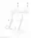 Fig. 03 - Catheter apparatus and operating method thereof