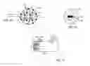 Fig. 10 - Methods and systems for treatment of a bladder