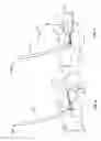 Fig. 05 - Systems and methods for anchoring medical devices