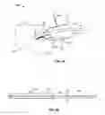 Fig. 06 - Systems and methods for anchoring medical devices
