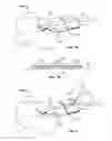 Fig. 07 - Systems and methods for anchoring medical devices