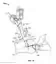Fig. 11 - Systems and methods for anchoring medical devices