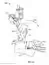 Fig. 12 - Systems and methods for anchoring medical devices