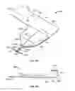 Fig. 15 - Systems and methods for anchoring medical devices