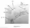 Fig. 28 - Cage for medical balloon