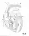 Fig. 11 - Elongated guide sheath