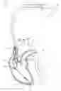 Fig. 01 - Left ventricular lead with active fixation