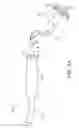 Fig. 05 - Interventional medical systems, catheters, and subassemblies