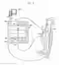 Fig. 03 - Neural prosthesis system and method of control