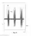 Fig. 07 - Neural prosthesis system and method of control