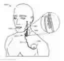 Fig. 01 - Methods, systems, and devices for pairing vagus nerve stimulation with motor therapy in stroke patients