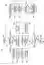 Fig. 13 - Programming and virtual reality representation of stimulation parameter groups