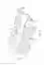 Fig. 06 - Waist training device