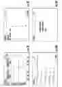 Fig. 10 - Reciprocating, dual directional, negative resistance, exercise machine