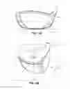 Fig. 03 - Golf club head