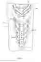 Fig. 17 - Protective apparatus with grooves