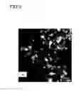 Fig. 10 - Process for the production of a carbon supported catalyst