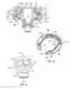 Fig. 08 - Bearing for umbilicus of a fluid processing system