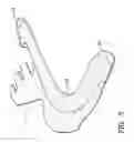 Fig. 03 - Utility glove