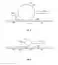 Fig. 05 - Methods and apparatus for forming microscopic features on a film layer
