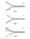 Fig. 03 - METHODS OF BONDING POLYESTER SUBSTRATES