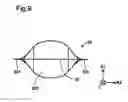 Fig. 10 - Injection method and liquid container