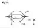 Fig. 47 - Injection method and liquid container
